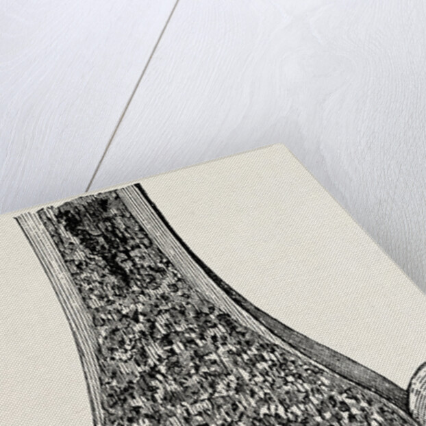 Radio-car lower end of the radius by Anonymous