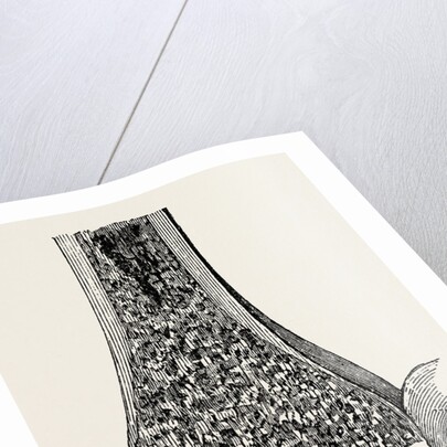 Radio-car lower end of the radius by Anonymous