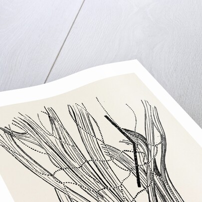 Excision of the wrist by Anonymous