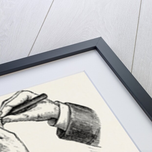 Excision of the elbow, the clearing of the humerus by Anonymous