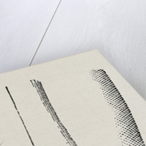 Excision by Anonymous