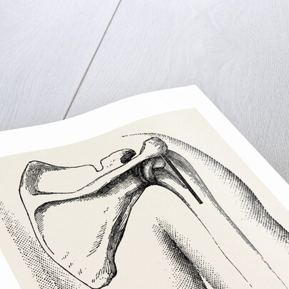 Excision of shoulder by Anonymous