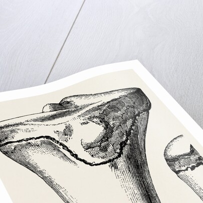 Epiphyses of the femur by Anonymous