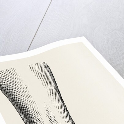 Incurved form of the foot, the planzar by Anonymous
