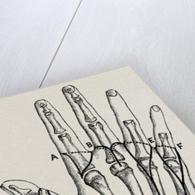 Disarticulation by Anonymous