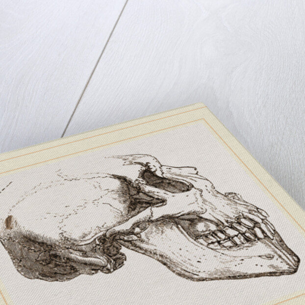 Skull of Human Idiot by Anonymous