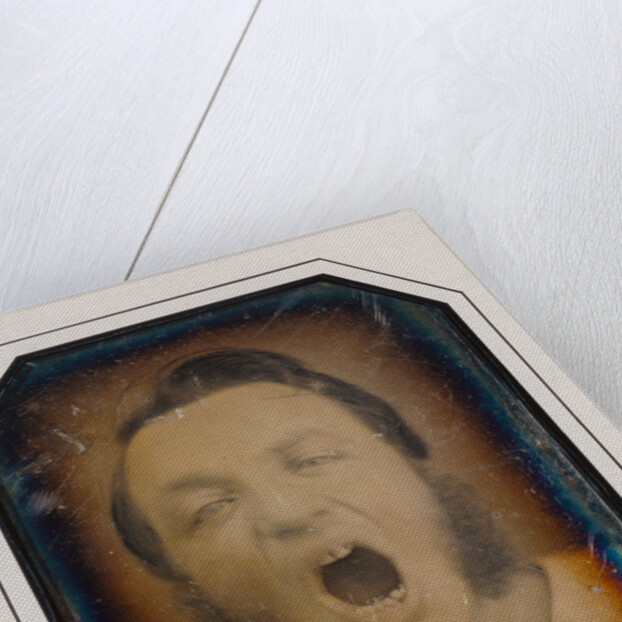 Man with Open Mouth by Anonymous