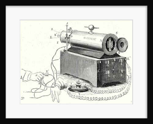 The Device of M. Duchenne (De Boulogne) by Anonymous