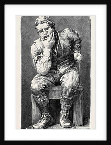 Toothache from a Figure in Stone by Mr. Anderson the Burns Centenary by Anonymous