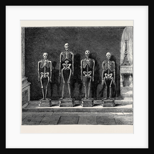 A Visit to the Battlefield of Solferino: Skeletons Found on the Battlefield by Anonymous