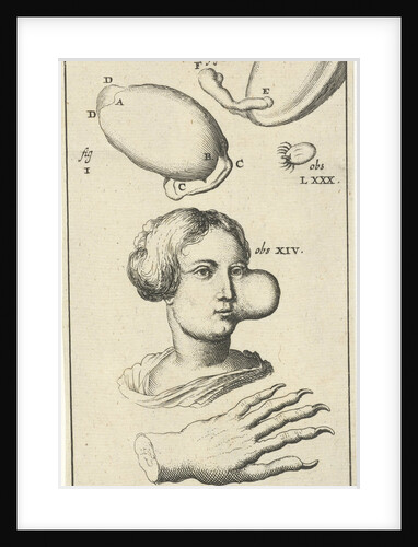Anatomical image XI by Jan Claesz ten Hoorn