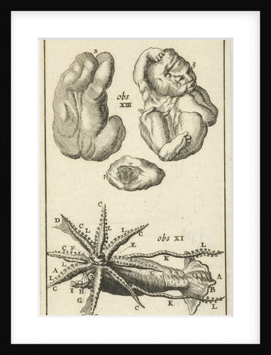Anatomical Figure I by Jan Claesz ten Hoorn