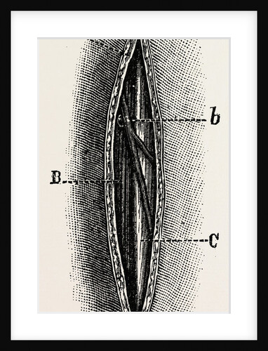 Ligature by Anonymous