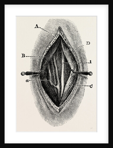 Ligature by Anonymous