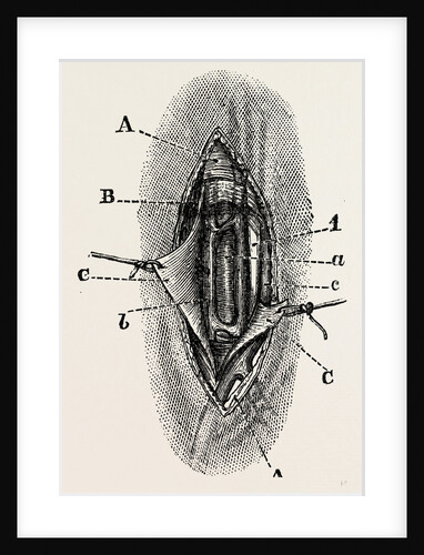 Ligature by Anonymous
