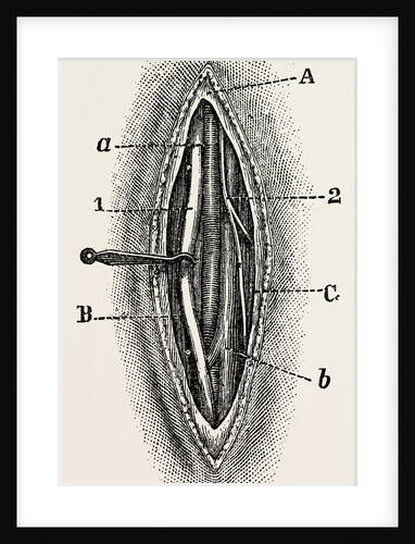 Ligature by Anonymous