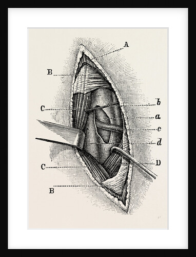 Ligature by Anonymous