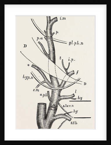 External carotid artery; natural size by Anonymous