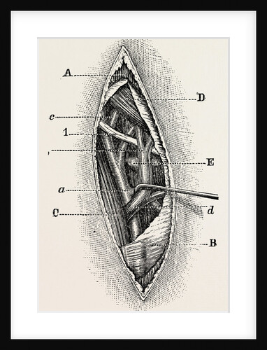 Ligature by Anonymous