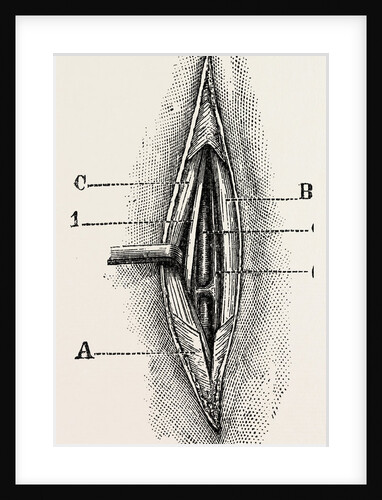 Ligature by Anonymous