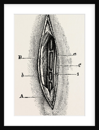 Ligature by Anonymous