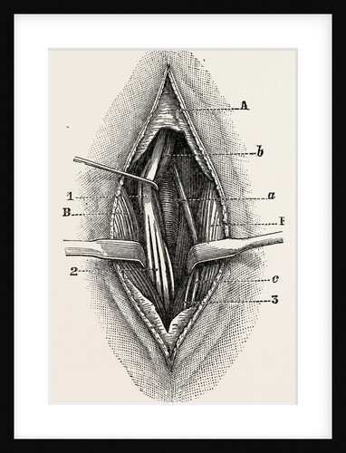Ligature by Anonymous