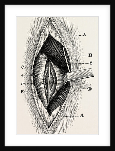 Ligature by Anonymous