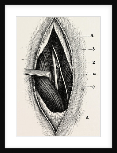 Ligature of by Anonymous
