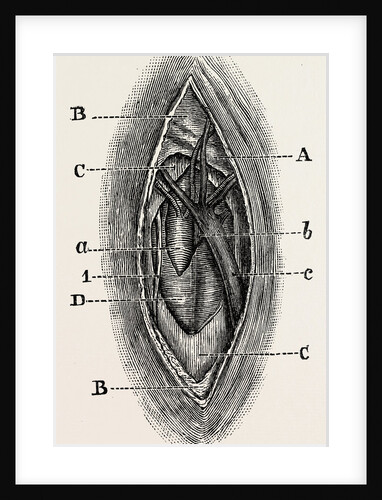 Ligature by Anonymous