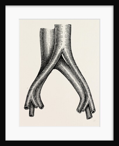 Relation of veins by Anonymous