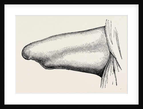 Conical stump following circular by Anonymous