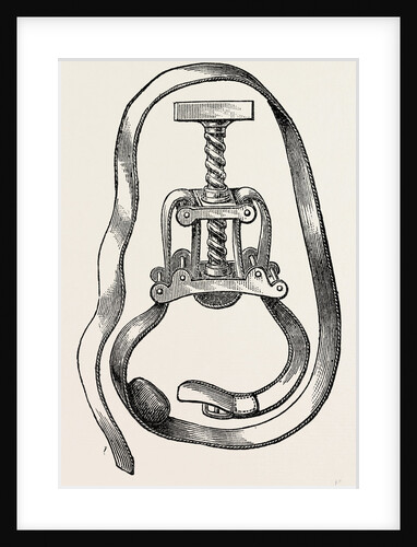 Petit's screw by Anonymous