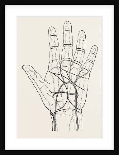 Surface markings on the palm of ffile hand by Anonymous