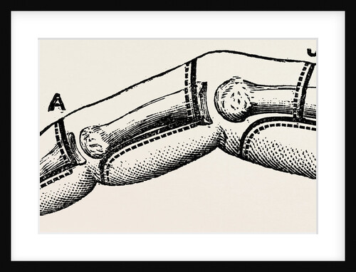 Disarticulations by Anonymous