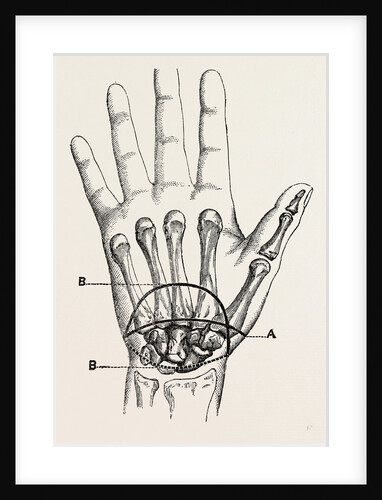 The first incision by Anonymous