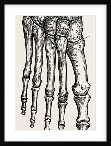 Bones by Anonymous