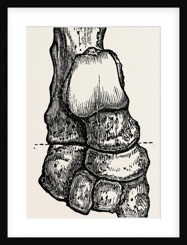 Bones by Anonymous