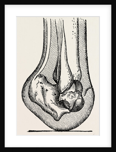 Anatomy by Anonymous