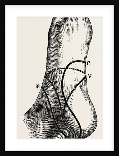 Inner and outer sides of the right foot by Anonymous