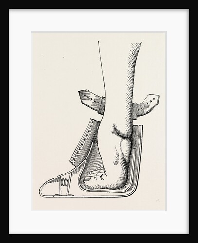 Aspect of limb by Anonymous
