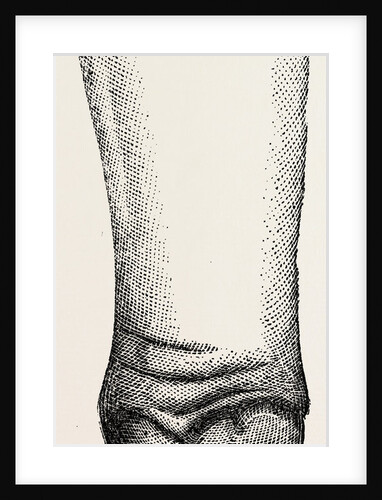 Stump by Anonymous