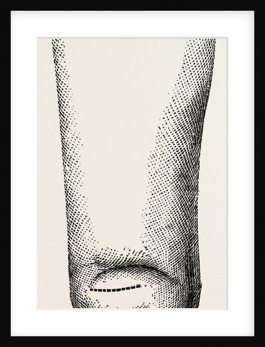 Stump by Anonymous