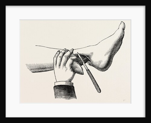 Mode of dividing the tissues in the amputation by Anonymous