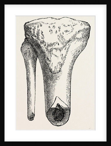 Method of sawing by Anonymous