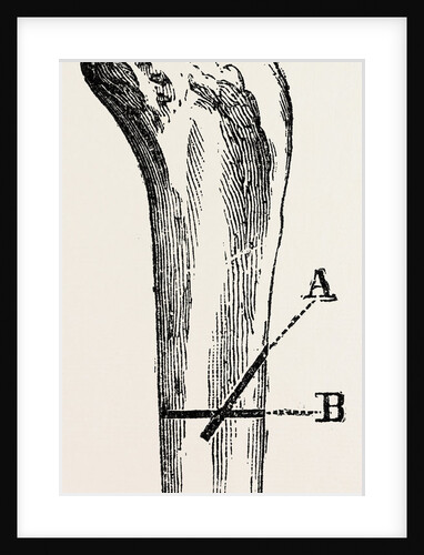 Method of method of sawing by Anonymous