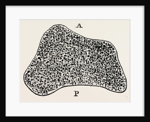 Transverse section by Anonymous