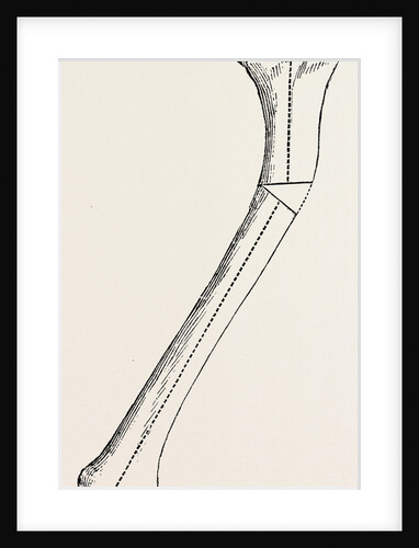 Bone by Anonymous