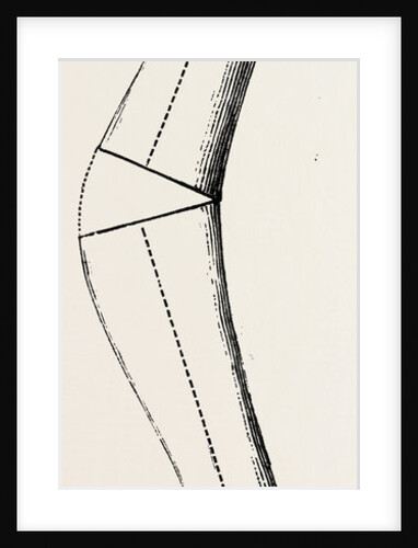 Cunei by Anonymous