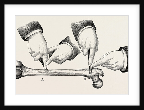 The method of using the rugine by Anonymous