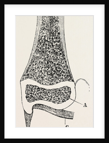 Lower end of the radius by Anonymous